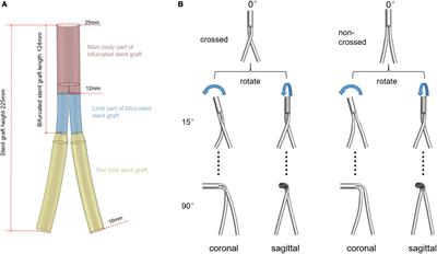 A Comparative Study on the Hemodynamic Performance Within Cross and Non-cross Stent-Grafts for Abdominal Aortic Aneurysms With an Angulated Neck